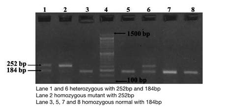 interpreting electrophoresis results|Part 2: Analysing and Interpreting (Agarose) Gel .